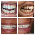 Thumbnail image 3 from Lillywhite Dental Practise