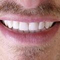 Thumbnail image 4 from Lillywhite Dental Practise