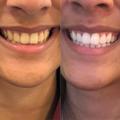 Thumbnail image 6 from Lillywhite Dental Practise